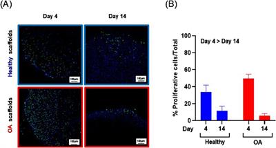 Healthy but not osteoarthritic human meniscus-derived matrix scaffolds promote meniscus repair